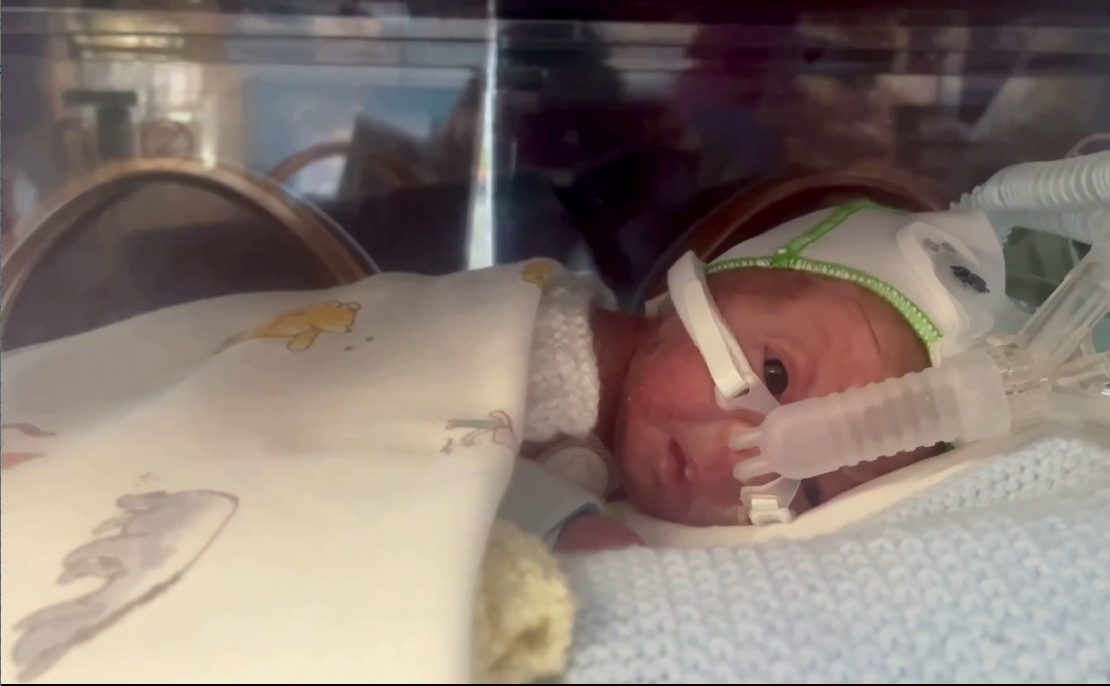 El motivo por el que los casos de la mortifera meningitis bacteriana estan aumentando en España : Trending de Colombia