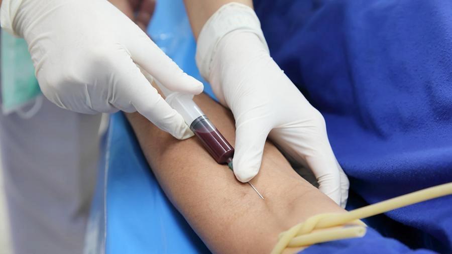 DETECCION TEMPRANA: Estudio britanico sugiere que un analisis de sangre podria acelerar diagnostico del cancer – este medio : Entretenimiento de Argentina