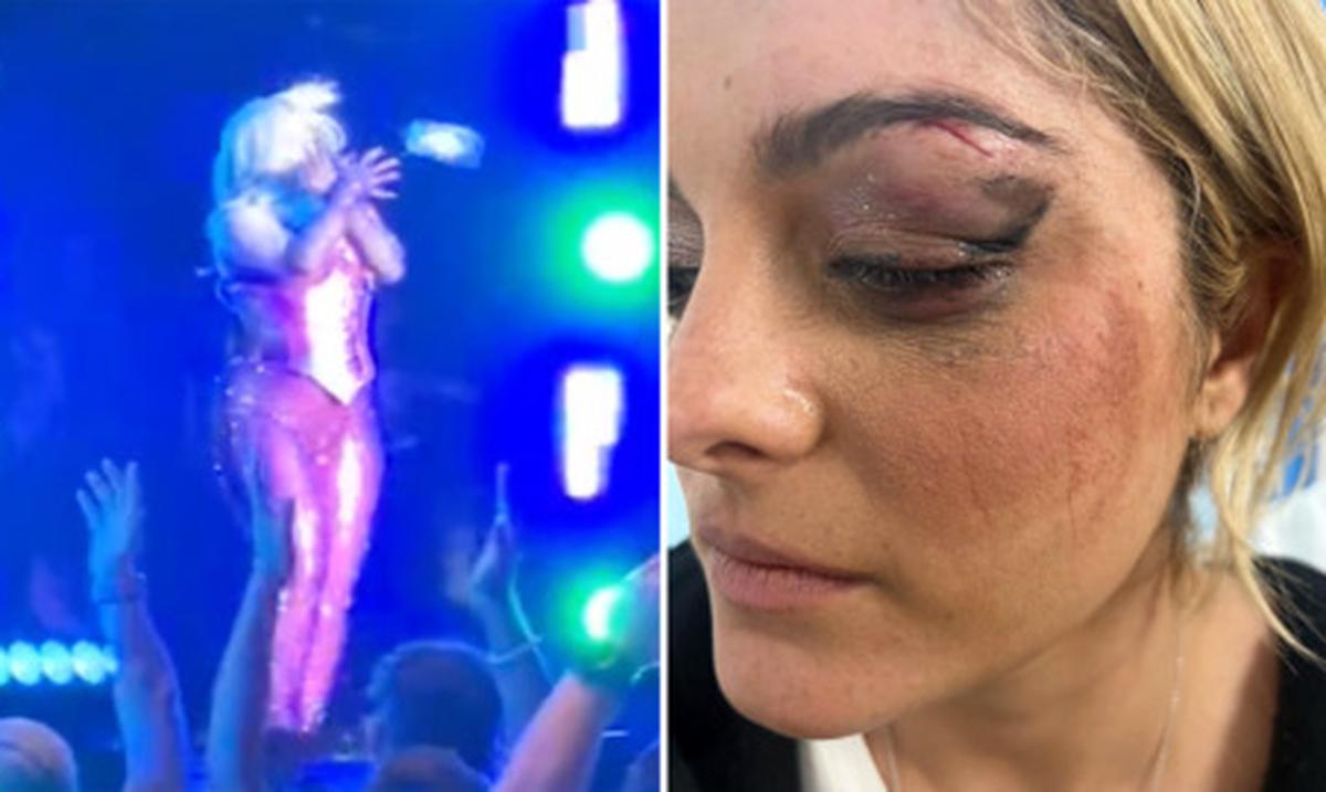 La cantante Bebe Rexha es golpeada con un celular en pleno concierto : Entretenimiento de Puerto Rico