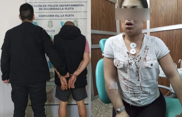 Detuvieron a un campeon sudamericano de boxeo tras fracturarle la mandibula a su expareja : Deportes de Argentina