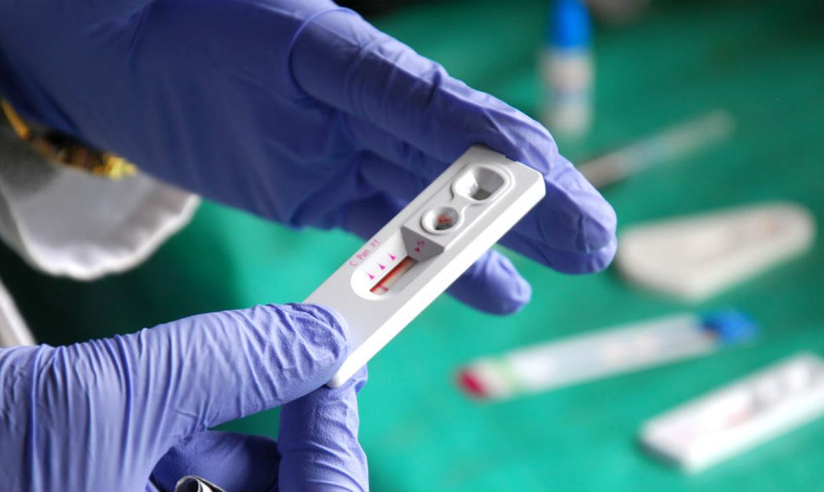 Puerto Rico reporta un caso de VIH al dia, aunque los contagios siguen bajando : Noticias de Puerto Rico