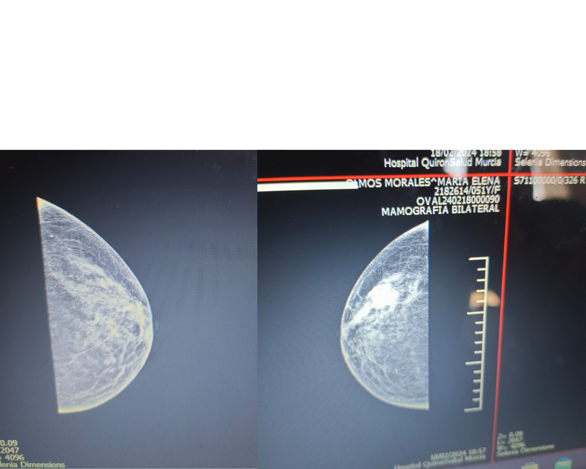 «Si hubiera hecho caso a la carta de la Consejeria no estaria viva» – Pitirre